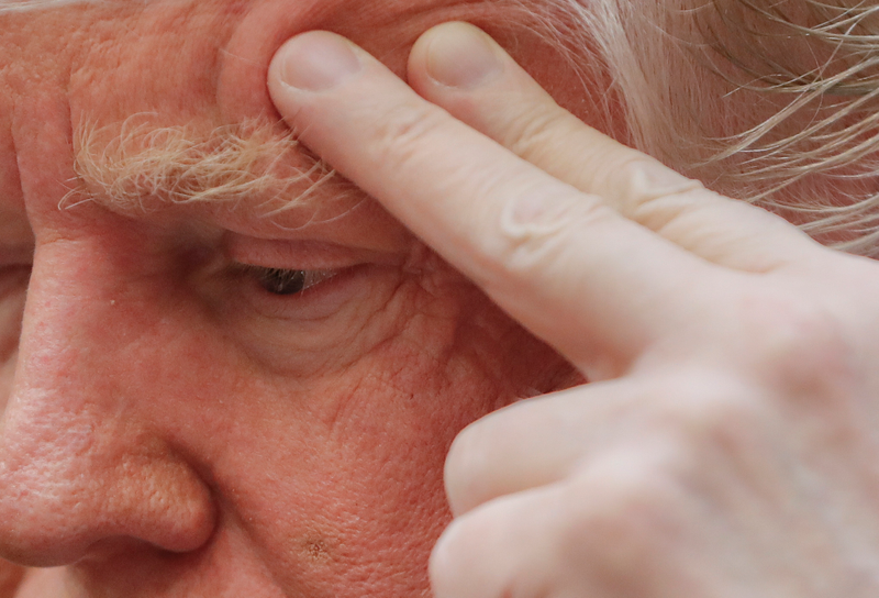Illustration for article titled Here Are Some Photographs of Donald Trump's Face and Hand